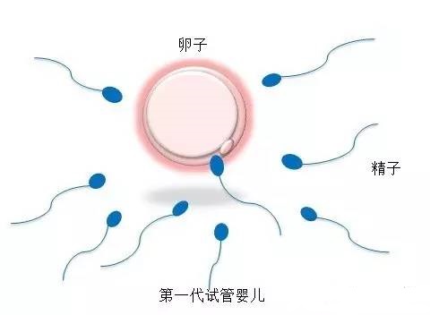 液氮储存
